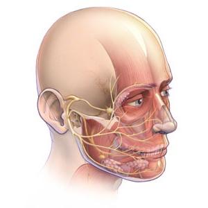 zapalenie nerwu twarzowego
